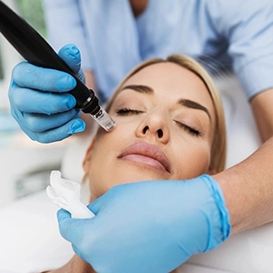 Microneedling
