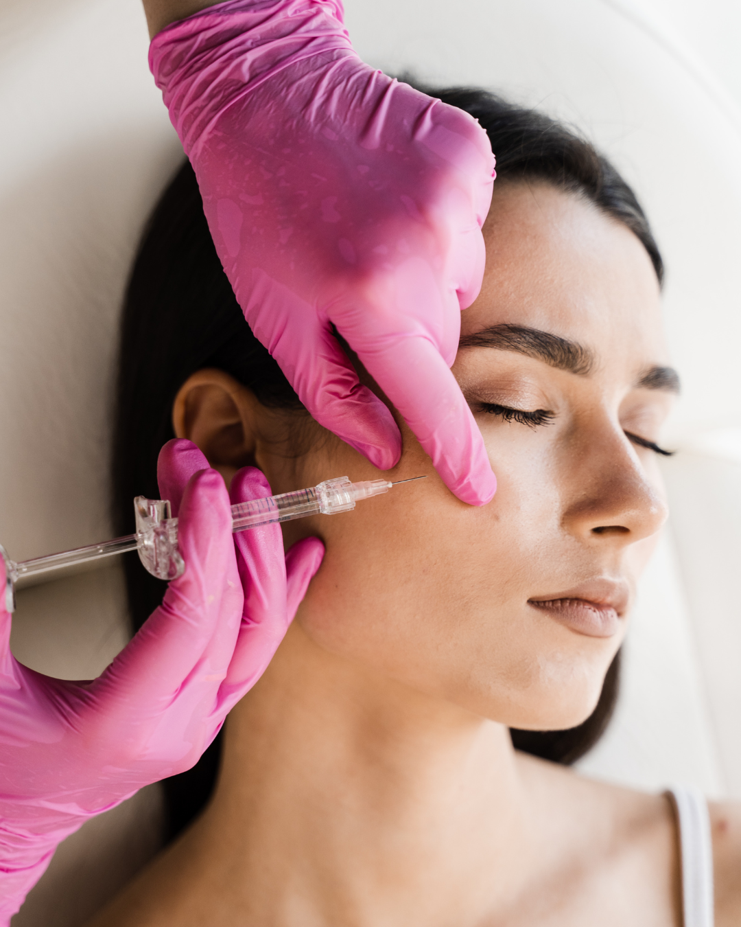 HA Fillers: Juvederm, Restylane